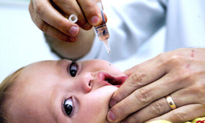 poliomielite dr david nordon ortopedista infantil